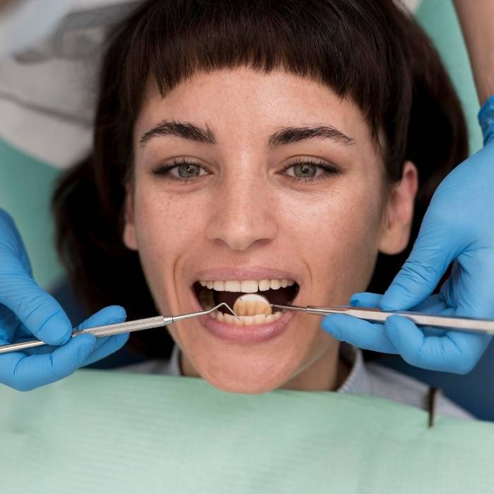 Zirconium Crowns